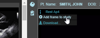 Add a Cine Frame to a Study – Studycast Support